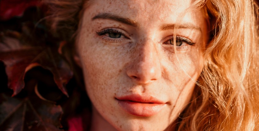 4 sposoby na przebarwienia