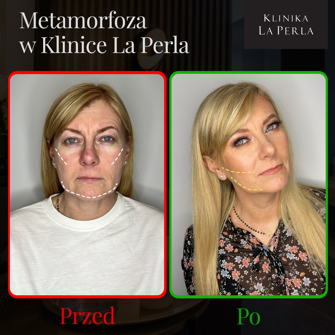 Jak zmieniło się życie Pani Beaty?